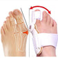 🔥Hot SALE- 【Läkare Rekommenderad】 Bunion Corrector för män och kvinnor
