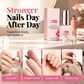 ✨3-i-1 nagelstärkande behandling, reparerande serum för svaga, mjuka och spruckna naglar, glänsande härdare för skadade naglar